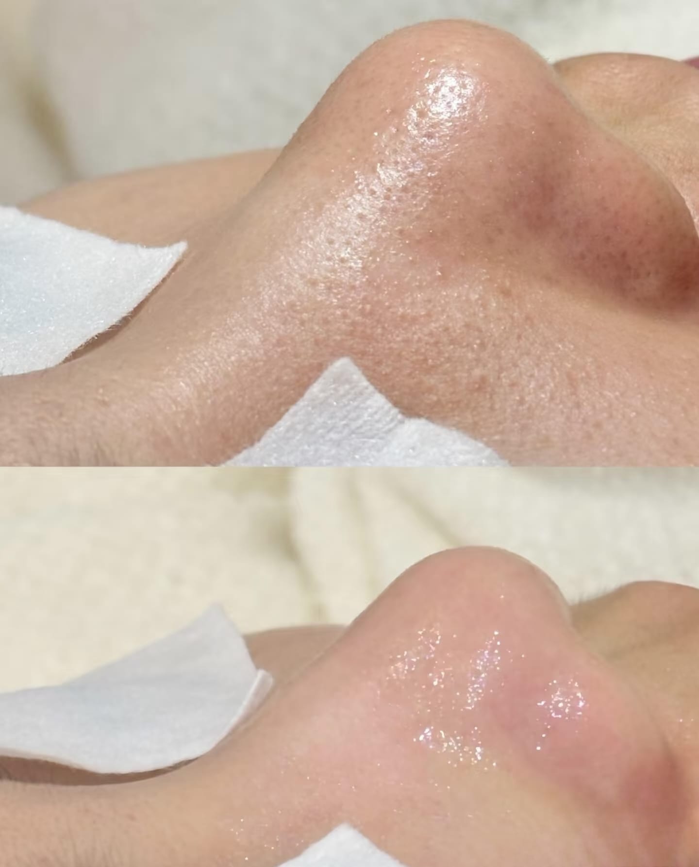 Before and after — knee skin treatment
