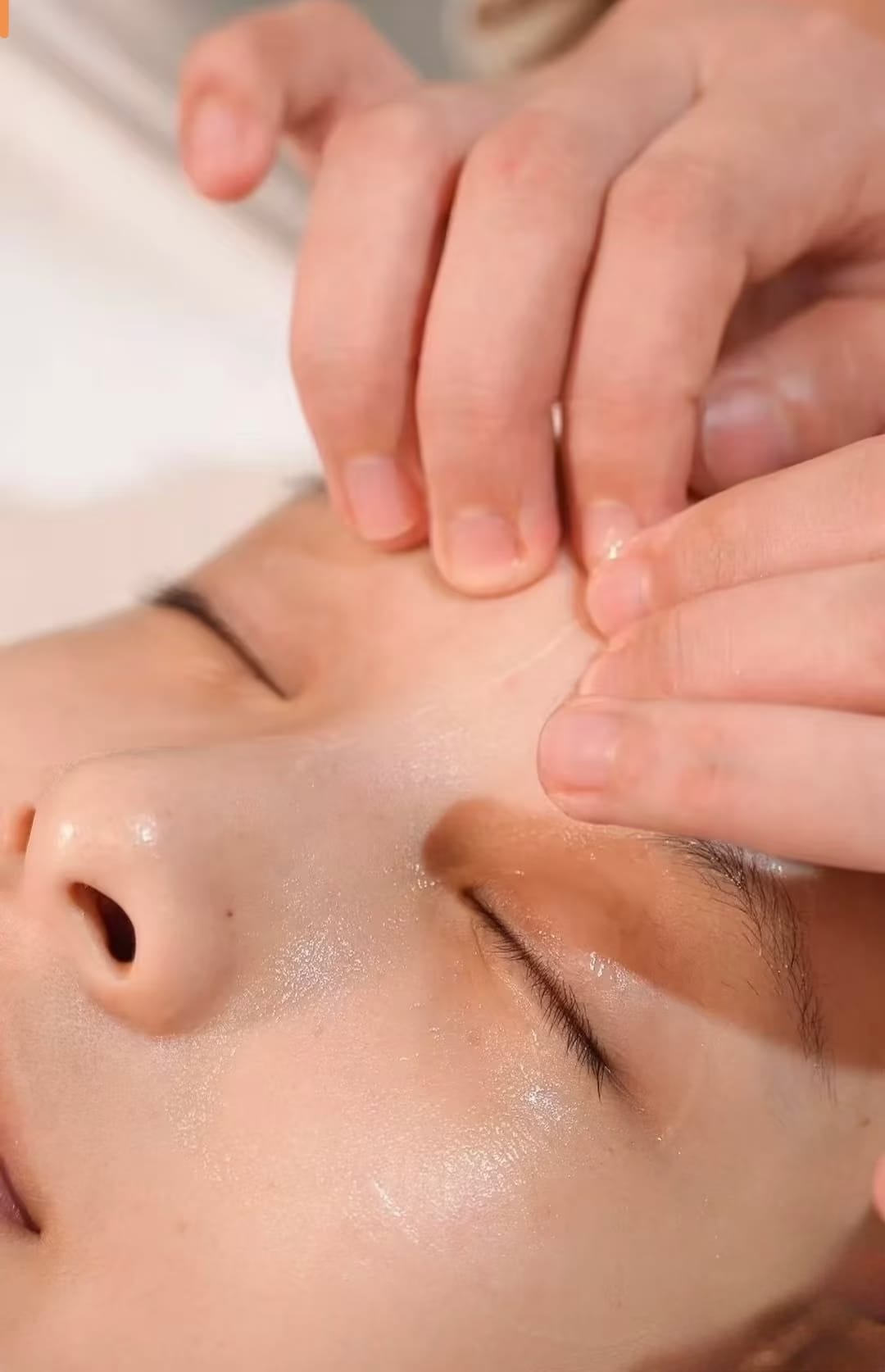 Before treatment — skin close-up