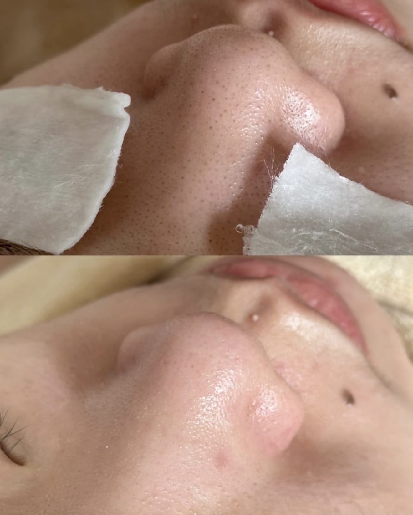 Li Beauty face mask treatment